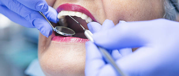 Best Emergency Root Canal Treatment in Shadyside, OH