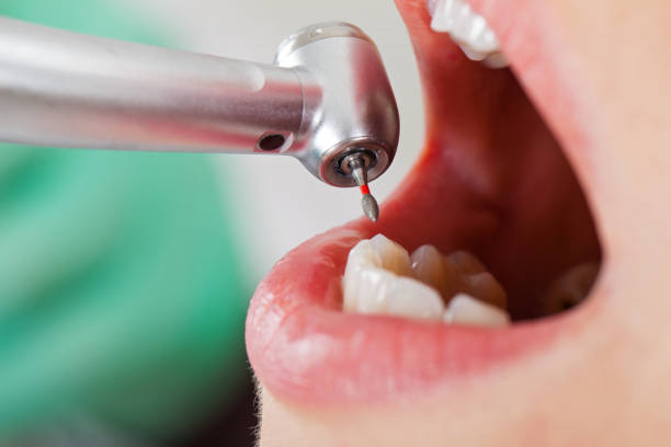 Best Orthodontic Emergency Dentist in Shadyside, OH